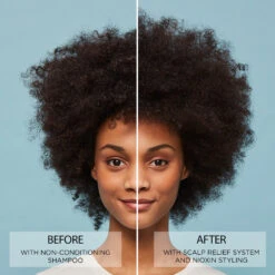 Nioxin Scalp Relief - 1Pièce -Magasin De Soins De Maquillage De Mode C2193029 S3