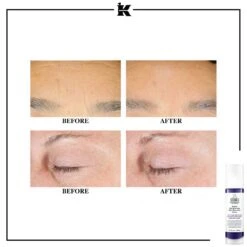 Kiehl's Retinol Skin-Renewing Daily Micro-Dose Serum - 30ml -Magasin De Soins De Maquillage De Mode P5301X06 S2
