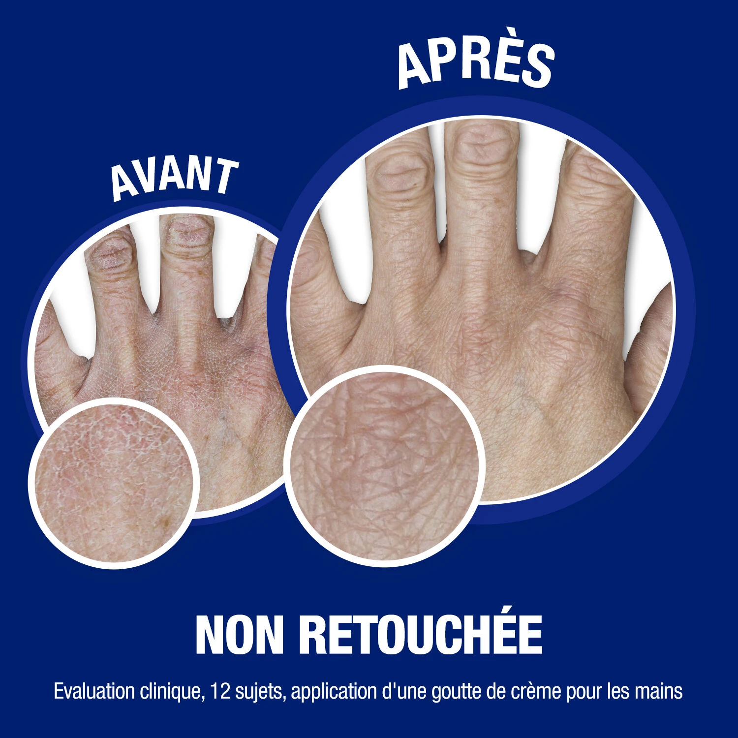 Neutrogena Crème Mains - 2Pièce 4 Neutrogena Crème Mains - 2Pièce – Image 4